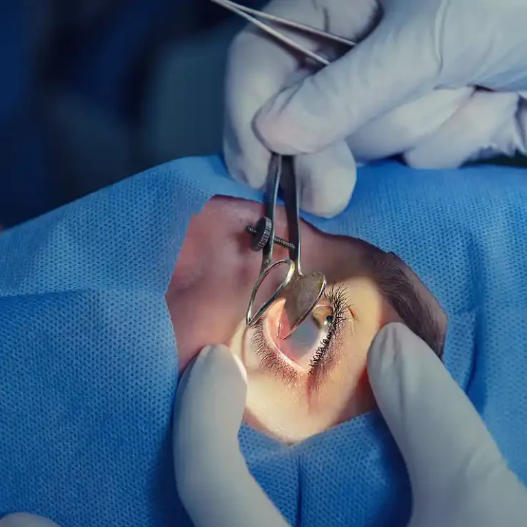 eye-surgery-with-retractors-and-fine-instruments-2026-03-10-03-55-58-utc 1 (1)